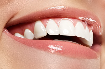 The Best Teeth Whitening Options Stiles Dental Care