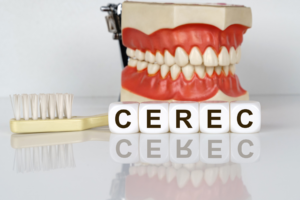 cerec crown