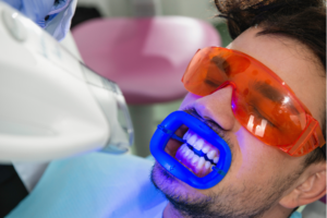 Man getting his teeth whitened