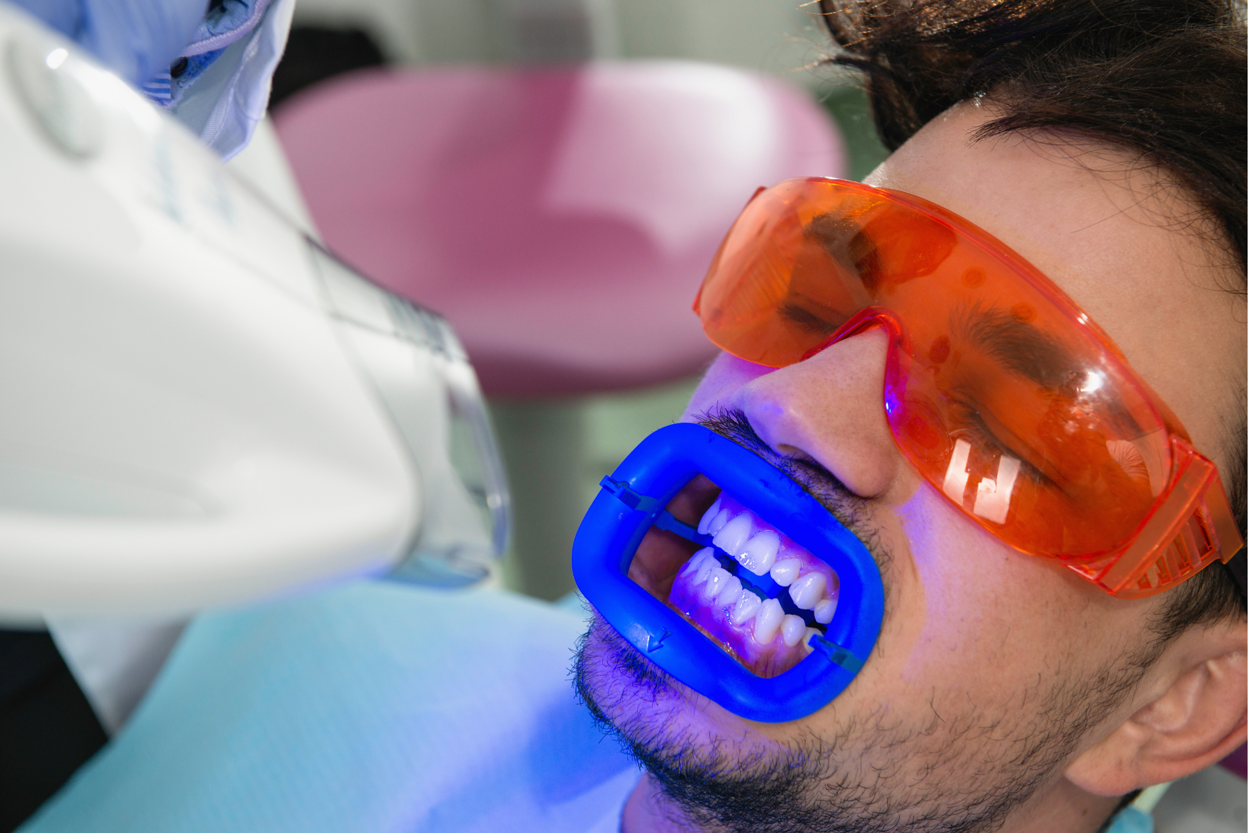 Teeth Whitening Options