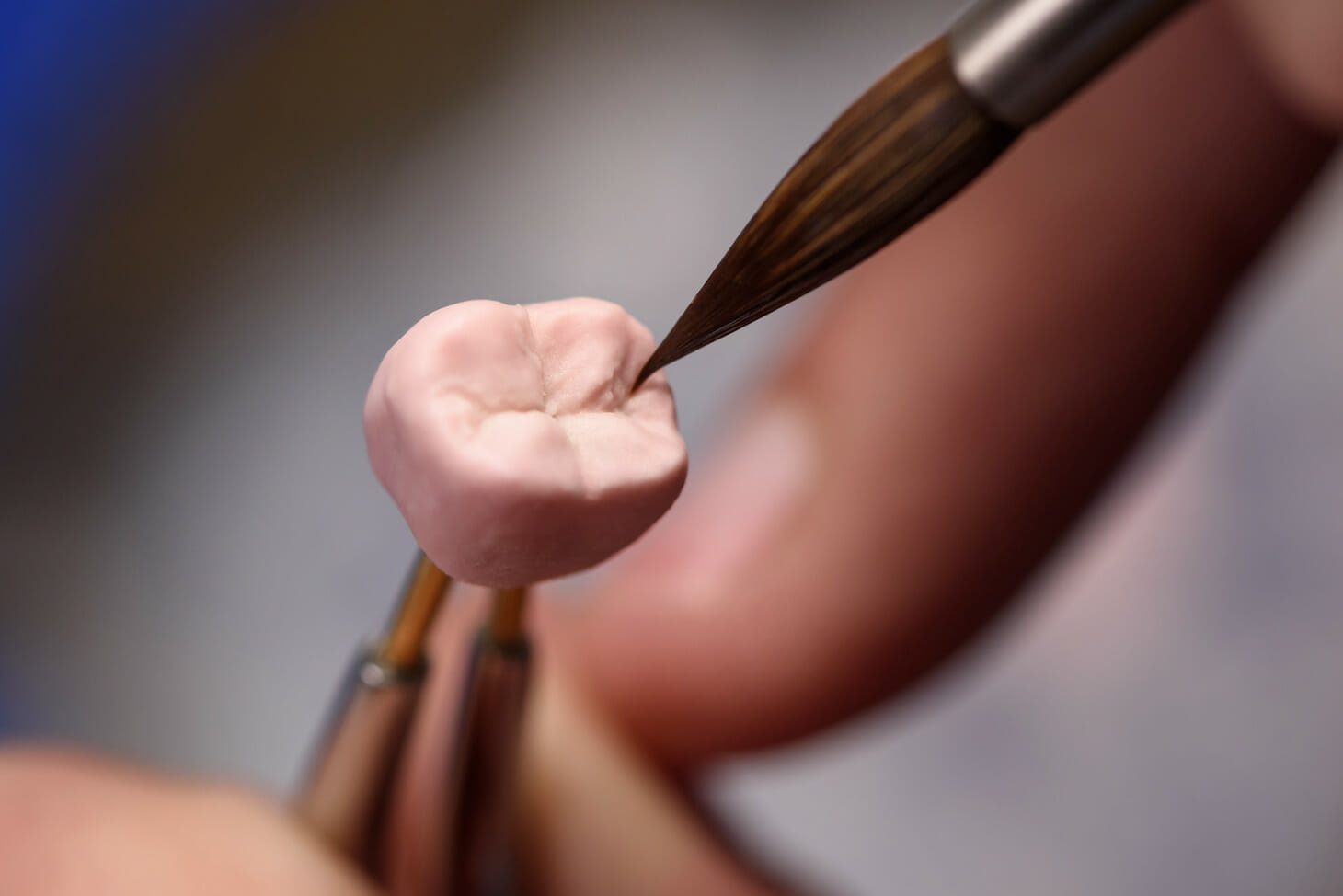 How Long Do CEREC Crowns Last?