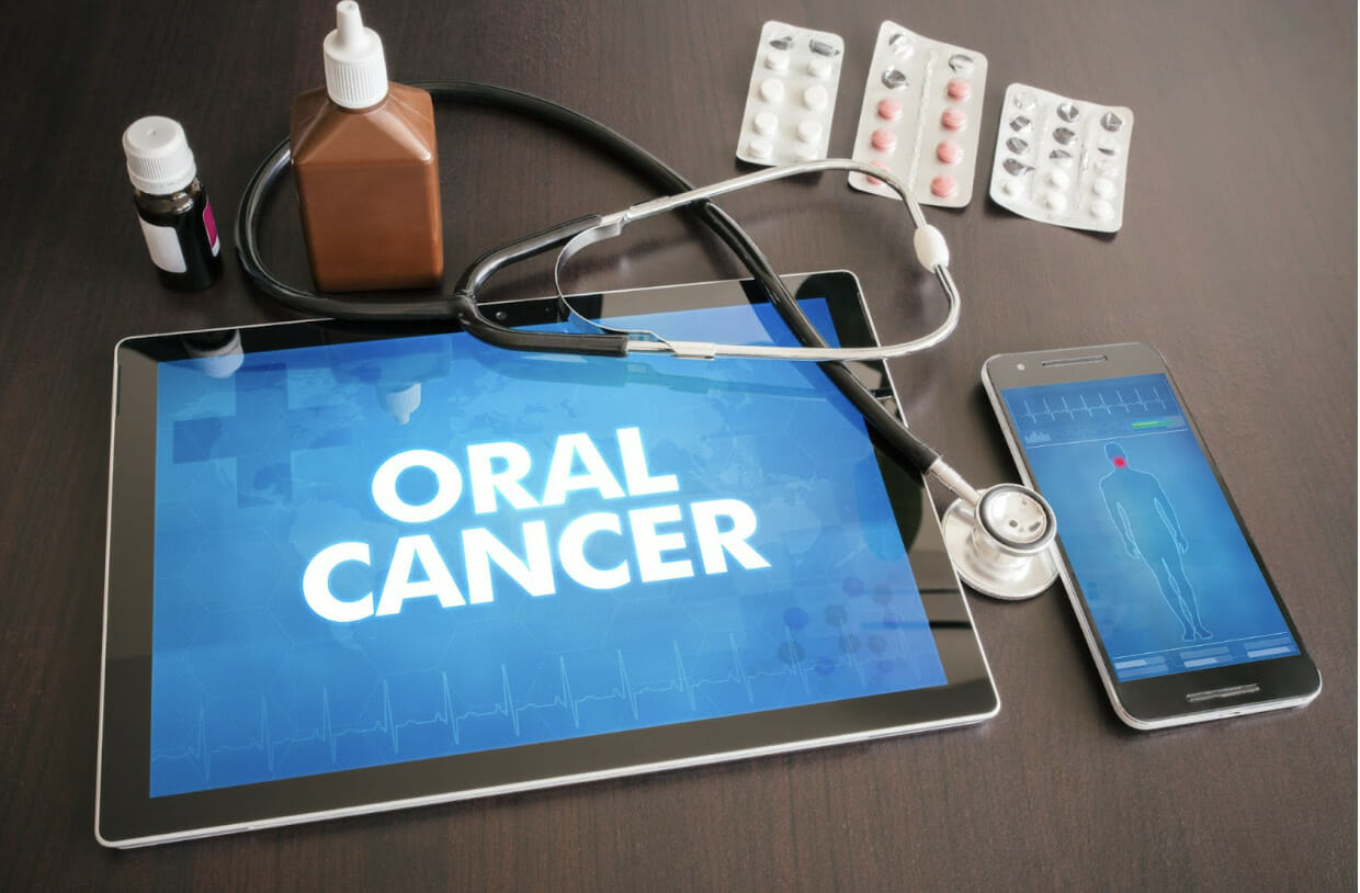 The Key To Fighting Oral Cancer Is Early Detection